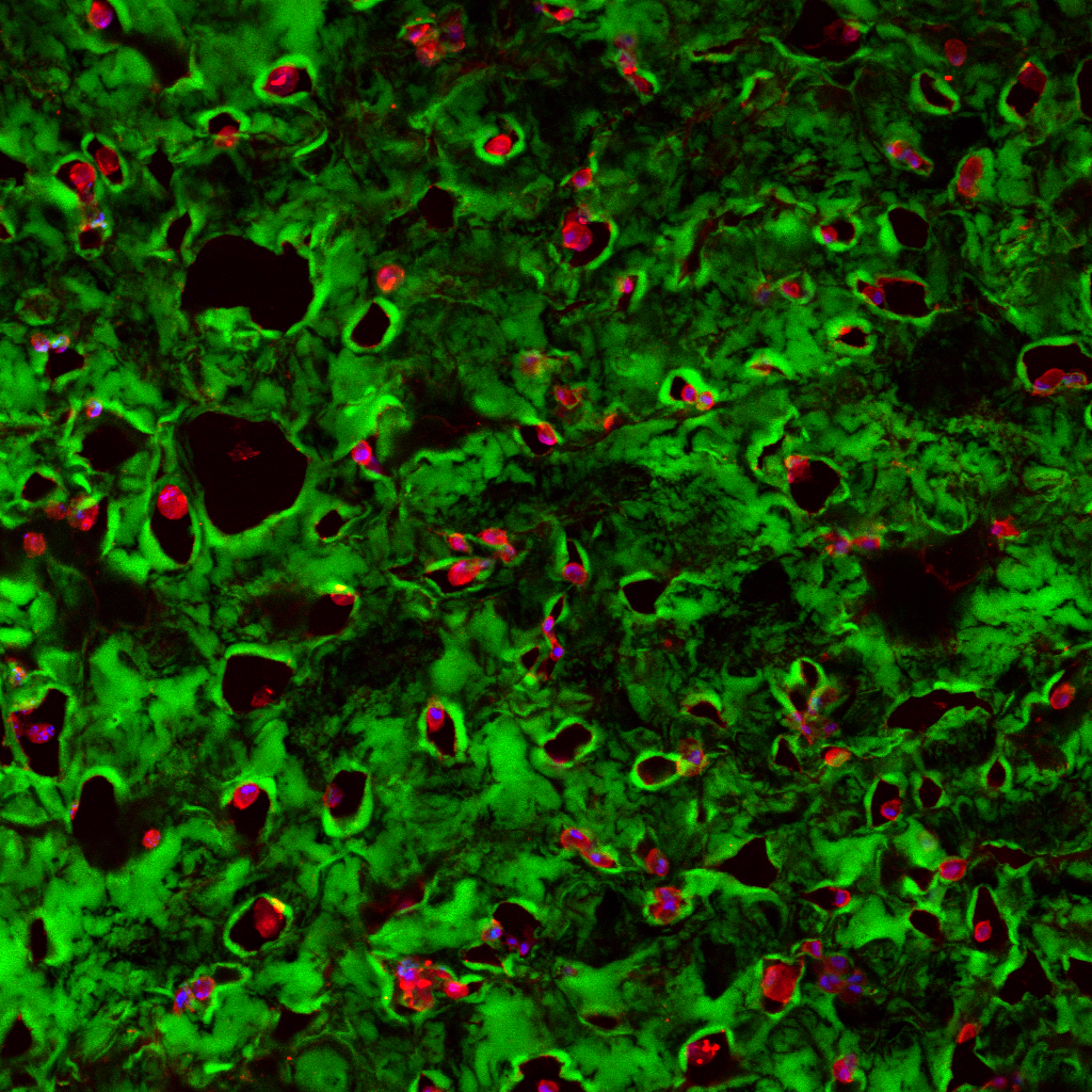 IPD 13 4wk Diff +MMP slide 5 Hoescht (b) MAP2 (r) B-VnRGD (g) 20x p1_PS