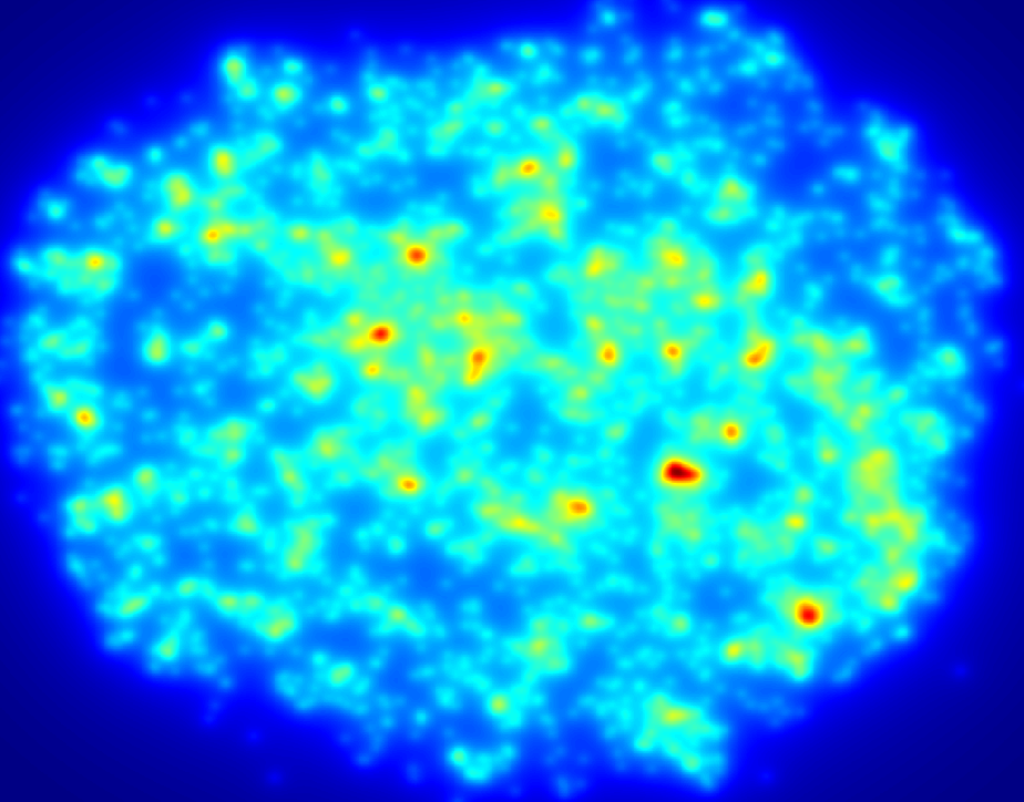 b-vnrgd-exp11-4wk-diff-slide-30_ipd-h11-3_mosaic_cellcounting