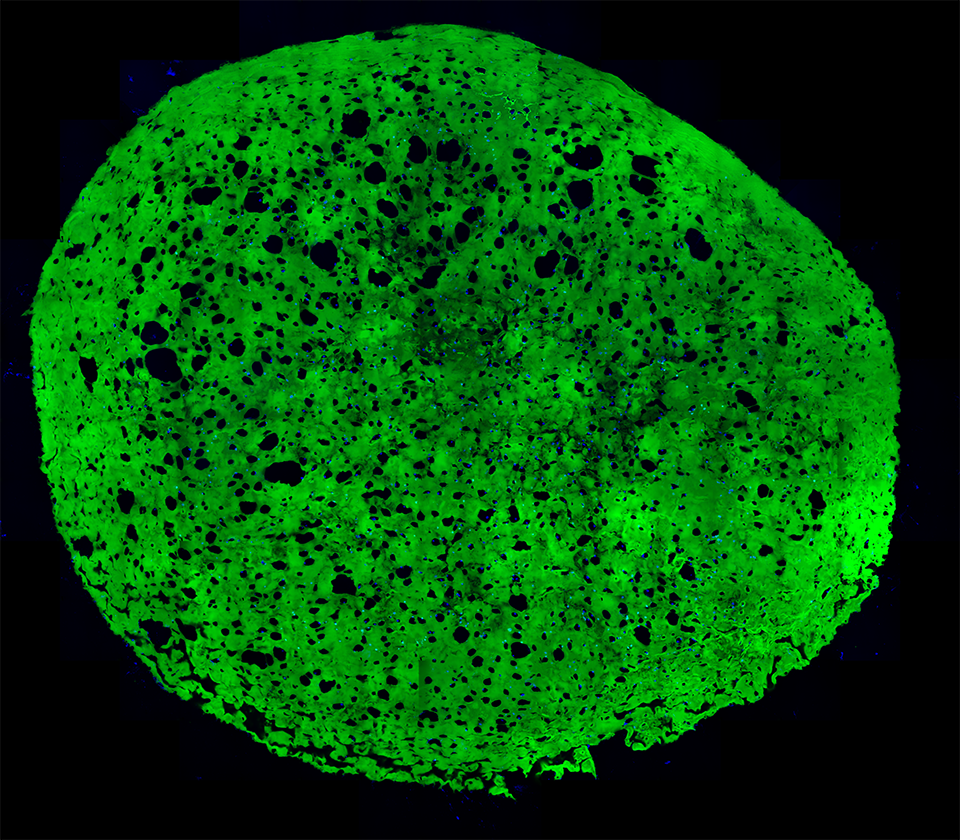 b-vnrgd-exp13-4wk-diff-slide-32_ipd-h15-3_mosaic