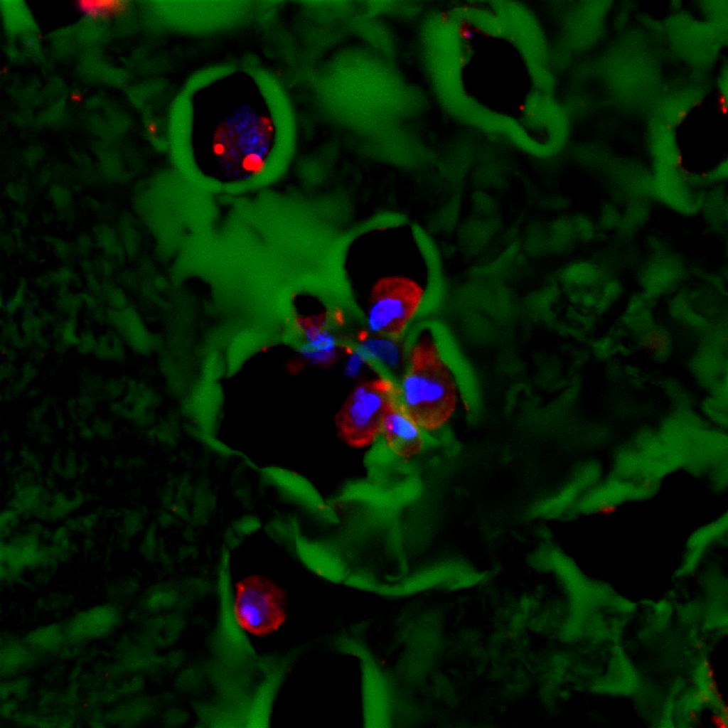 ipd-13-4wk-diff-mmp-slide-77-hoescht-b-map2-r-b-vnrgd-g-40x-p2-sb-20um