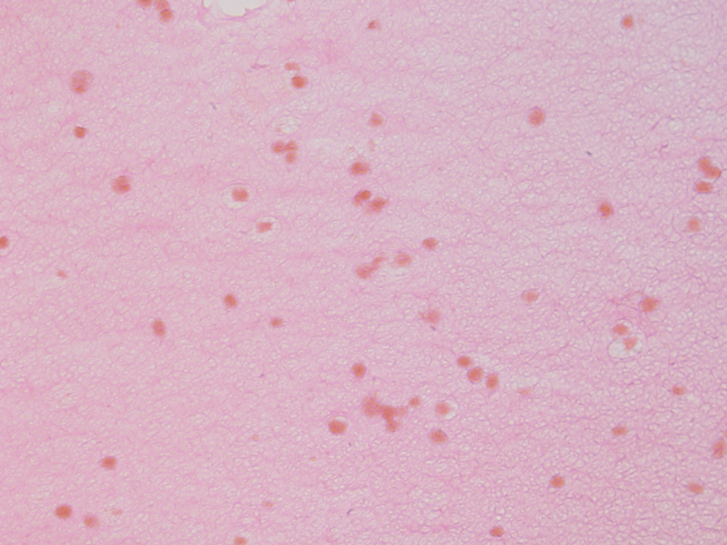 ipd-14-slide-42-undiff-h_e-stain-20x-3