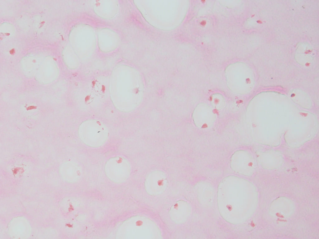 ipd-16-slide-70-diff-h_e-stain-20x-1